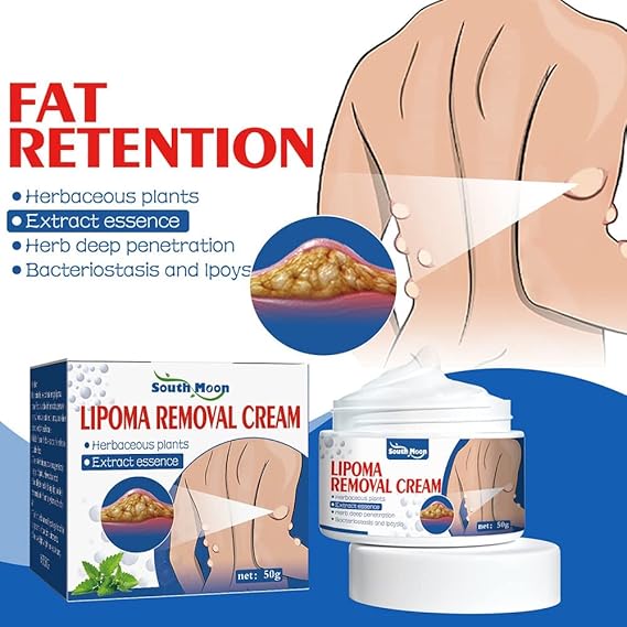 South Moon Lipoma Removal Cream buy one get 2 free