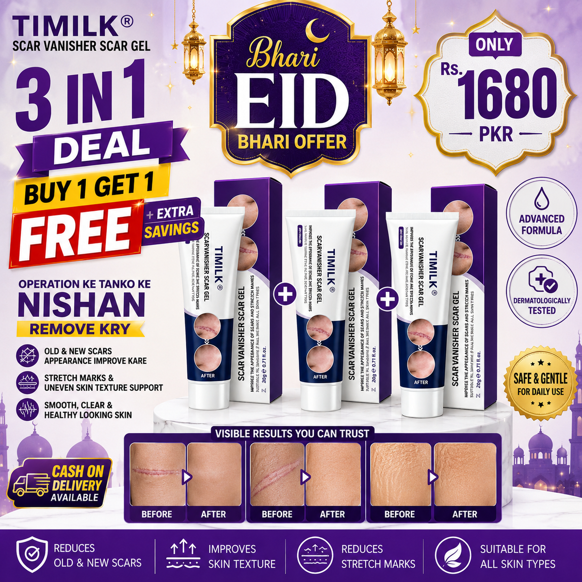 TIMILK Scar Vanisher Gel – Advanced Silicone Formula for Scars, Stretch Marks & Smooth Skin